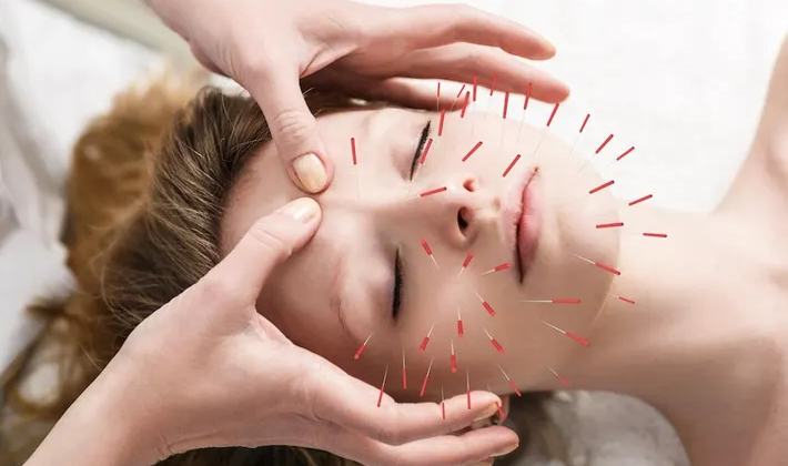 Cosmetic Acupuncture vs. Botox: A Natural Alternative for Skin Rejuvenation