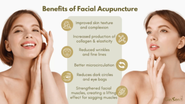 The Anti-Aging Benefits of Cosmetic Facial Acupuncture