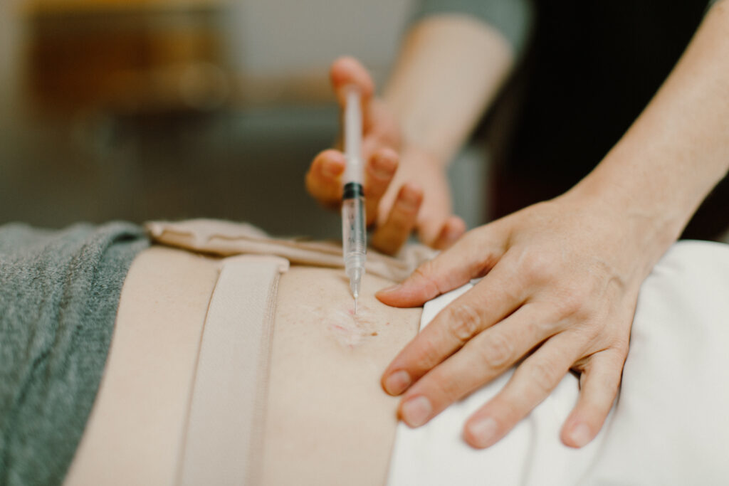 What Conditions Can Acupuncture Injection Therapy Treat?