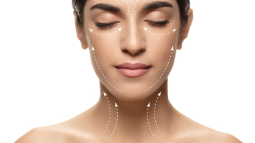 Acupuncture for Acne and Skin Conditions: A Holistic Solution