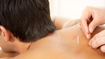 Combining Acupuncture with Nutrition: Tips for a Holistic Wellness Routine