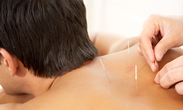 Combining Acupuncture with Nutrition: Tips for a Holistic Wellness Routine